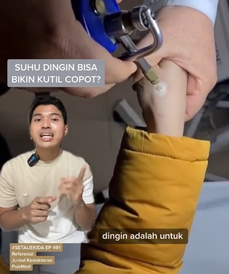 Gambar Konten #SETAUEKIDA tentang Kutil Dibekuin (Sumber: Instagram @ekidarehanf)